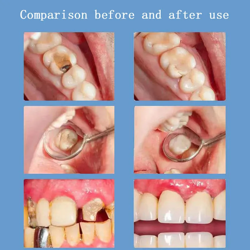Anti-Cavity & Teeth Repair Probiotic Toothpaste – Strengthens & Protects Your Smile