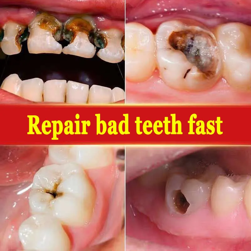 Anti-Cavity & Teeth Repair Probiotic Toothpaste – Strengthens & Protects Your Smile